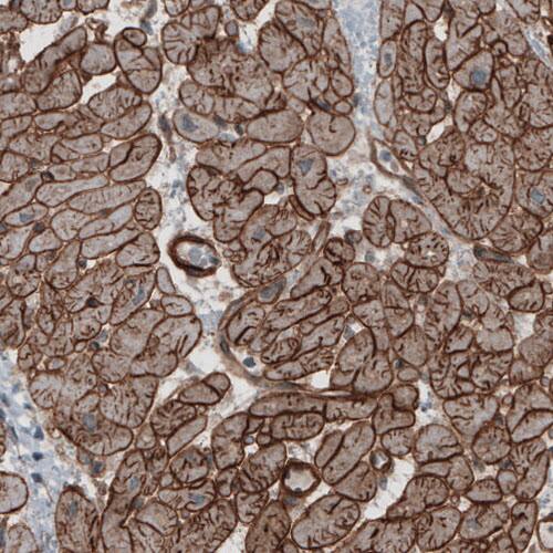 Laminin S/Laminin beta 2 Antibody (CL2976) - Azide and BSA Free Immunohistochemistry-Paraffin: Laminin S/Laminin beta 2 Antibody [NBP3-44400]