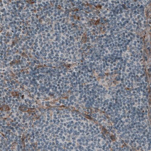Laminin S/Laminin beta 2 Antibody (CL2976) - Azide and BSA Free Immunohistochemistry-Paraffin: Laminin S/Laminin beta 2 Antibody [NBP3-44400]