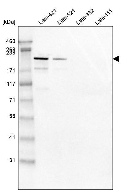 Laminin S/Laminin beta 2 Antibody (CL2976) - Azide and BSA Free Western Blot: Laminin S/Laminin beta 2 Antibody [NBP3-44400]
