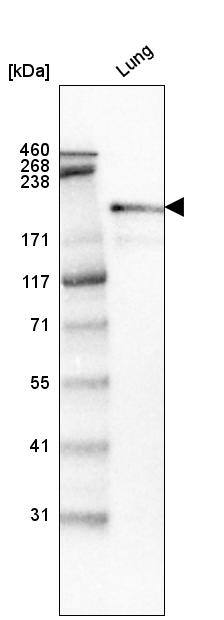 Laminin S/Laminin beta 2 Antibody (CL2979) - Azide and BSA Free Western Blot: Laminin S/Laminin beta 2 Antibody [NBP3-44401]