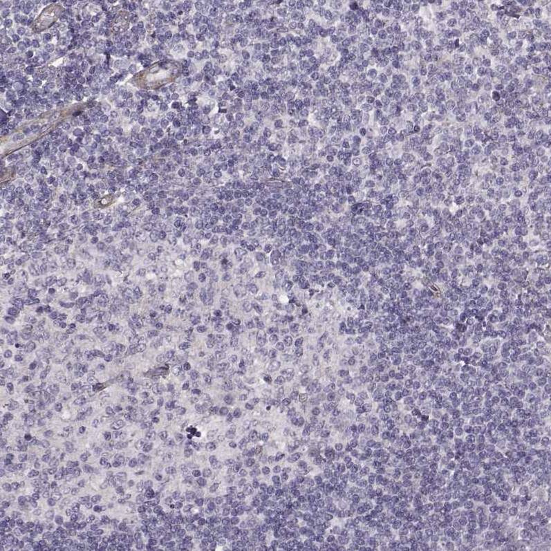 Laminin S/Laminin beta 2 Antibody (CL2979) - Azide and BSA Free Immunohistochemistry-Paraffin: Laminin S/Laminin beta 2 Antibody [NBP3-44401]