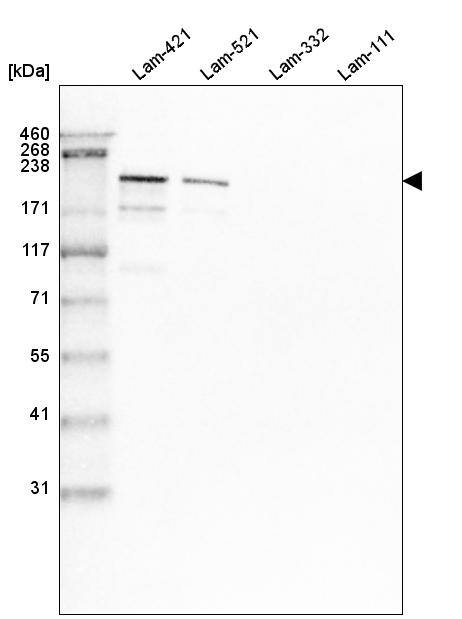 Laminin S/Laminin beta 2 Antibody (CL2979) - Azide and BSA Free Western Blot: Laminin S/Laminin beta 2 Antibody [NBP3-44401]