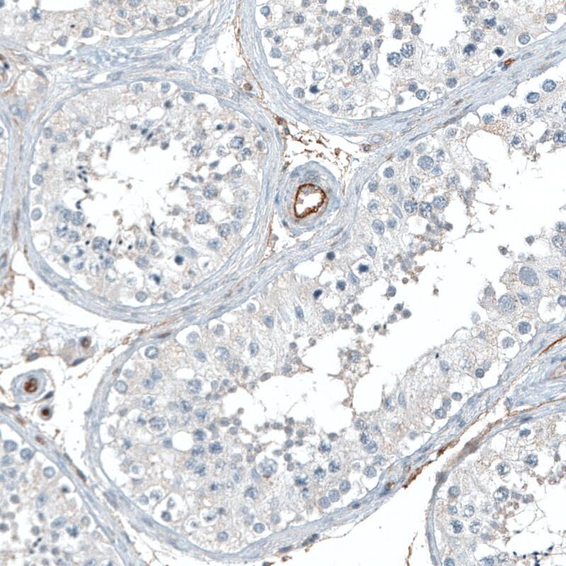 Integrin alpha 5/CD49e Antibody (CL6940) - Azide and BSA Free Immunohistochemistry-Paraffin: Integrin alpha 5/CD49e Antibody [NBP3-44402]