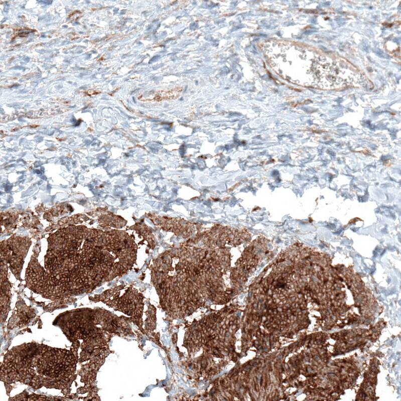 Integrin alpha 5/CD49e Antibody (CL6940) - Azide and BSA Free Immunohistochemistry-Paraffin: Integrin alpha 5/CD49e Antibody [NBP3-44402]