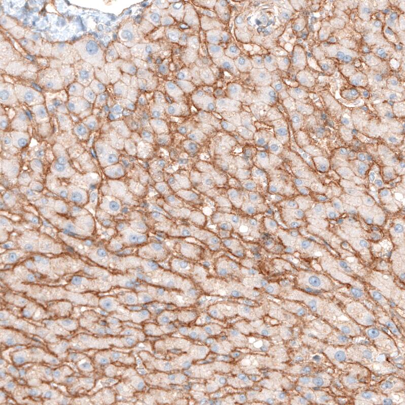 Integrin alpha 5/CD49e Antibody (CL6945) - Azide and BSA Free Immunohistochemistry-Paraffin: Integrin alpha 5/CD49e Antibody [NBP3-44403]