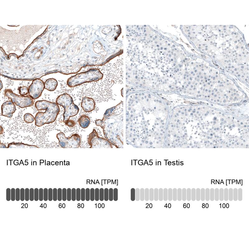 Integrin alpha 5/CD49e Antibody (CL6945) - Azide and BSA Free Immunohistochemistry-Paraffin: Integrin alpha 5/CD49e Antibody [NBP3-44403]