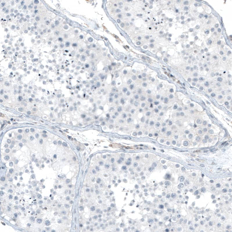 Integrin alpha 5/CD49e Antibody (CL6945) - Azide and BSA Free Immunohistochemistry-Paraffin: Integrin alpha 5/CD49e Antibody [NBP3-44403]