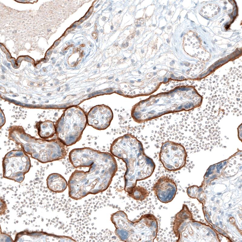 Integrin alpha 5/CD49e Antibody (CL6945) - Azide and BSA Free Immunohistochemistry-Paraffin: Integrin alpha 5/CD49e Antibody [NBP3-44403]