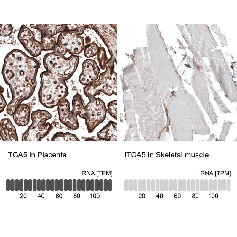 Integrin alpha 5/CD49e Antibody (CL6951) - Azide and BSA Free Immunohistochemistry-Paraffin: Integrin alpha 5/CD49e Antibody [NBP3-44404]