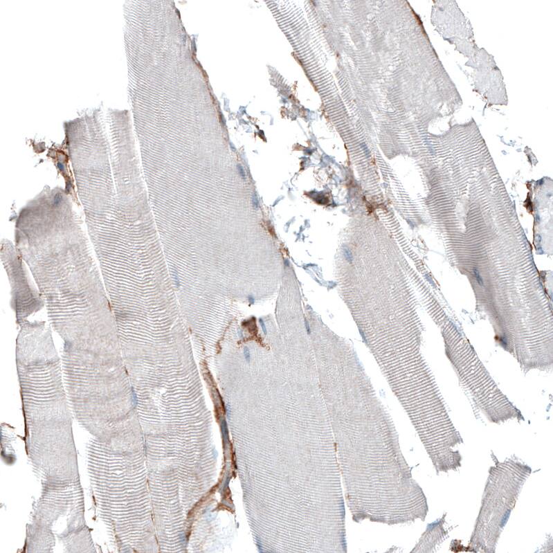 Integrin alpha 5/CD49e Antibody (CL6951) - Azide and BSA Free Immunohistochemistry-Paraffin: Integrin alpha 5/CD49e Antibody [NBP3-44404]