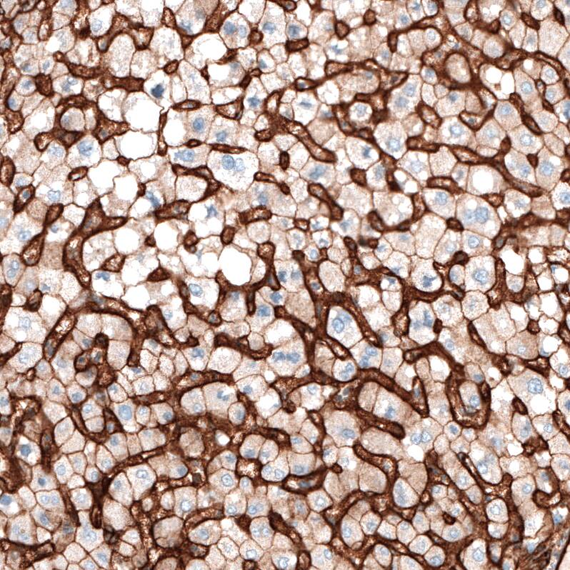 Integrin alpha 5/CD49e Antibody (CL6951) - Azide and BSA Free Immunohistochemistry-Paraffin: Integrin alpha 5/CD49e Antibody [NBP3-44404]