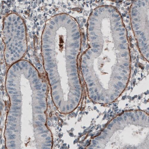 Laminin gamma 1 Antibody (CL3196) - Azide and BSA Free Immunohistochemistry-Paraffin: Laminin gamma 1 Antibody [NBP3-44405]