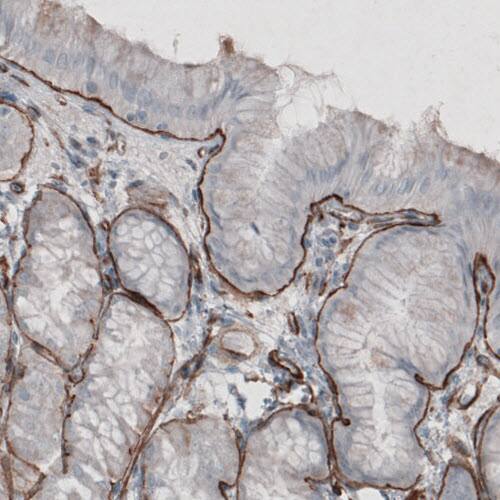 Laminin gamma 1 Antibody (CL3196) - Azide and BSA Free Immunohistochemistry-Paraffin: Laminin gamma 1 Antibody [NBP3-44405]