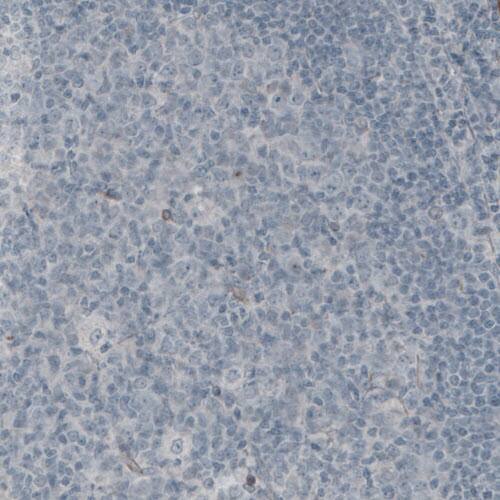 Laminin gamma 1 Antibody (CL3196) - Azide and BSA Free Immunohistochemistry-Paraffin: Laminin gamma 1 Antibody [NBP3-44405]