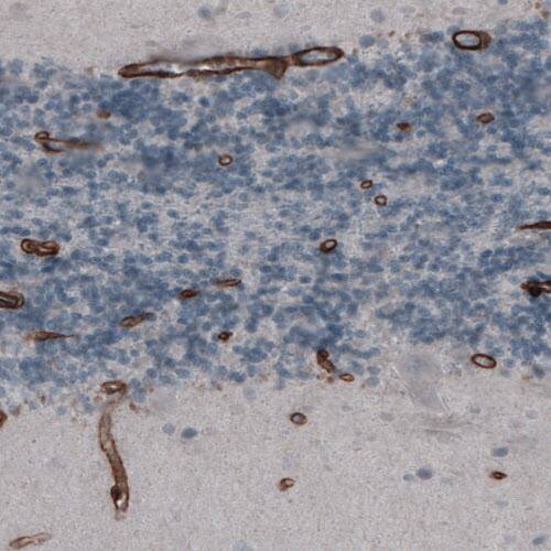 Laminin gamma 1 Antibody (CL3195) - Azide and BSA Free Immunohistochemistry-Paraffin: Laminin gamma 1 Antibody [NBP3-44406]