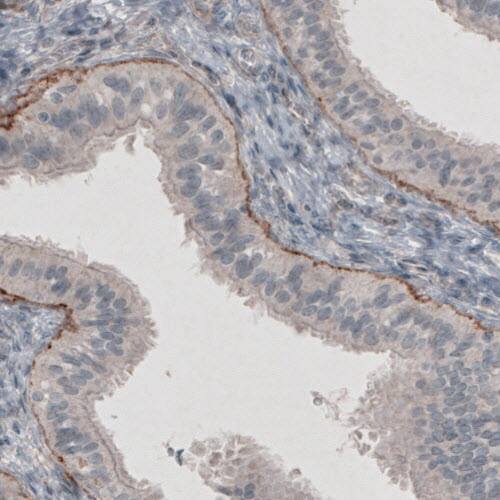 Laminin gamma 1 Antibody (CL3195) - Azide and BSA Free Immunohistochemistry-Paraffin: Laminin gamma 1 Antibody [NBP3-44406]