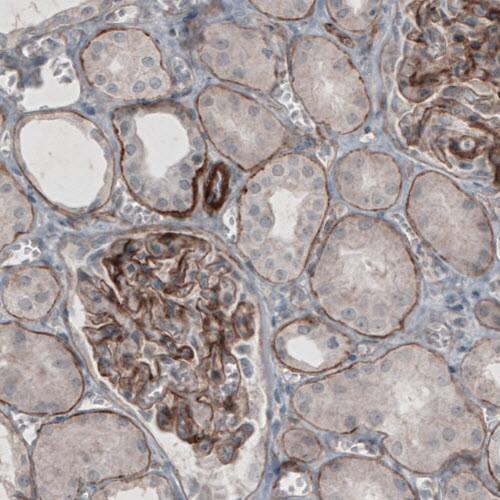 Laminin gamma 1 Antibody (CL3195) - Azide and BSA Free Immunohistochemistry-Paraffin: Laminin gamma 1 Antibody [NBP3-44406]