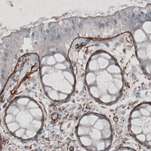 Laminin gamma 1 Antibody (CL3195) - Azide and BSA Free Immunohistochemistry-Paraffin: Laminin gamma 1 Antibody [NBP3-44406]
