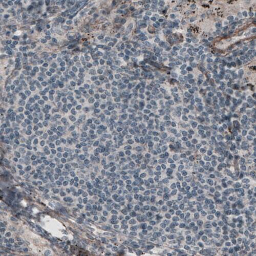 Laminin gamma 1 Antibody (CL3195) - Azide and BSA Free Immunohistochemistry-Paraffin: Laminin gamma 1 Antibody [NBP3-44406]