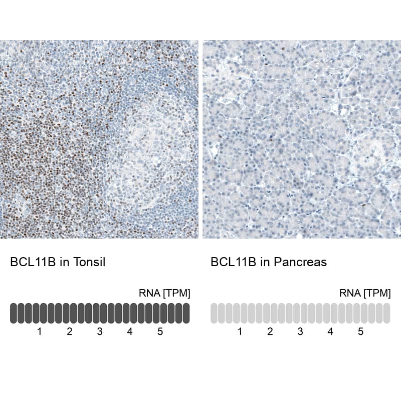 BCL11B Antibody (CL6426) - Azide and BSA Free Immunohistochemistry-Paraffin: BCL11B Antibody [NBP3-44407]