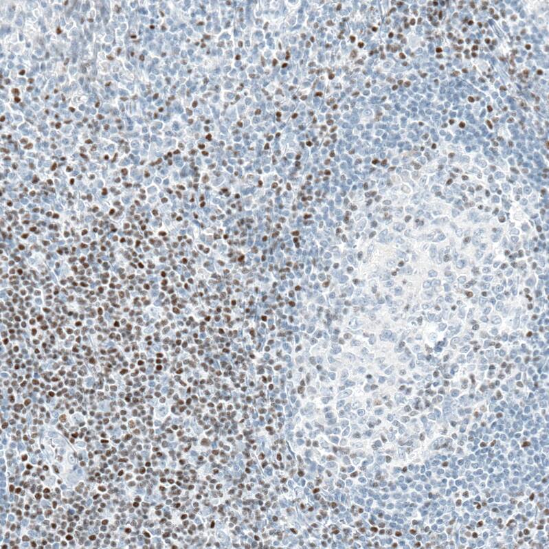 BCL11B Antibody (CL6426) - Azide and BSA Free Immunohistochemistry-Paraffin: BCL11B Antibody [NBP3-44407]