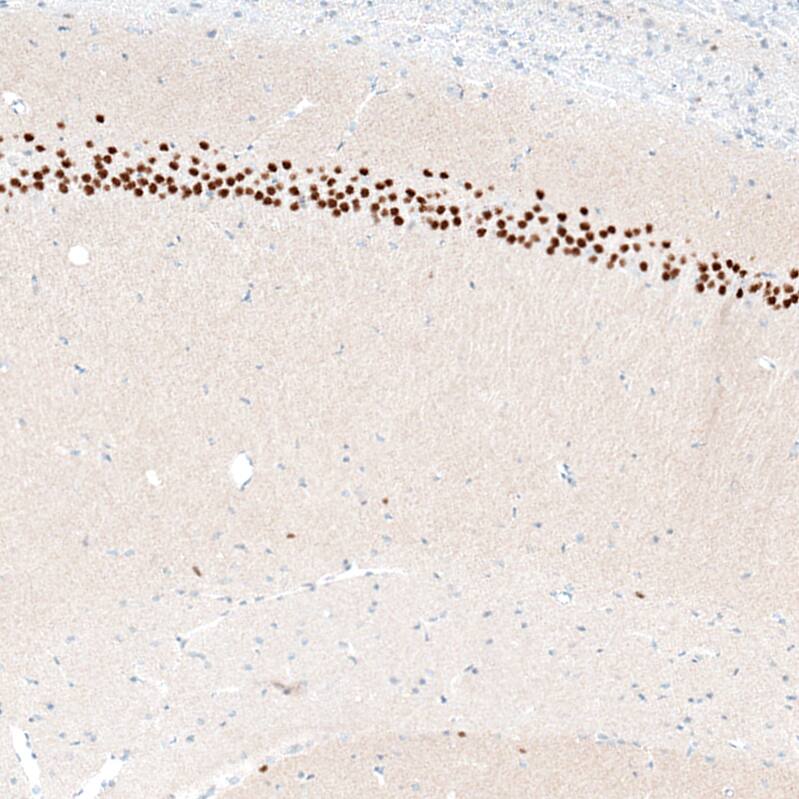 BCL11B Antibody (CL6426) - Azide and BSA Free Immunohistochemistry-Paraffin: BCL11B Antibody [NBP3-44407]