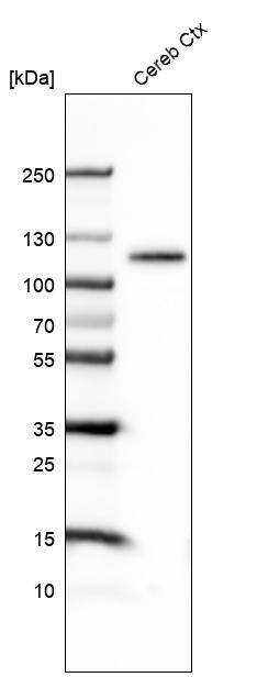 BCL11B Antibody (CL6426) - Azide and BSA Free Western Blot: BCL11B Antibody [NBP3-44407]