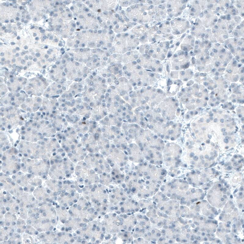 BCL11B Antibody (CL6426) - Azide and BSA Free Immunohistochemistry-Paraffin: BCL11B Antibody [NBP3-44407]