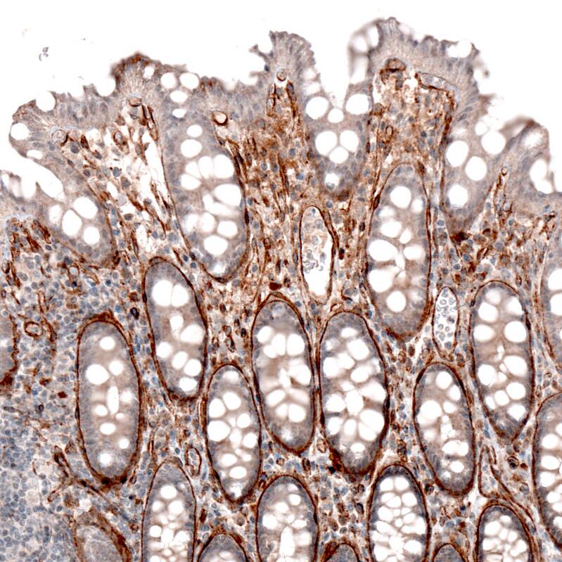 Laminin alpha 4 Antibody (CL3183) - Azide and BSA Free Immunohistochemistry-Paraffin: Laminin alpha 4 Antibody [NBP3-44408]
