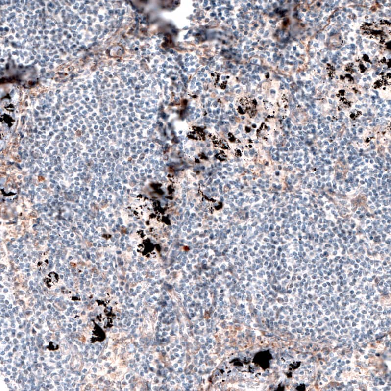 Laminin alpha 4 Antibody (CL3183) - Azide and BSA Free Immunohistochemistry-Paraffin: Laminin alpha 4 Antibody [NBP3-44408]