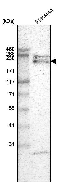 Laminin alpha 4 Antibody (CL3183) - Azide and BSA Free Western Blot: Laminin alpha 4 Antibody [NBP3-44408]