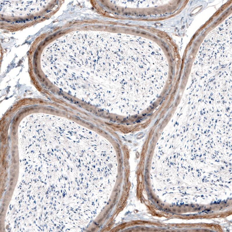 Laminin alpha 4 Antibody (CL3183) - Azide and BSA Free Immunohistochemistry-Paraffin: Laminin alpha 4 Antibody [NBP3-44408]