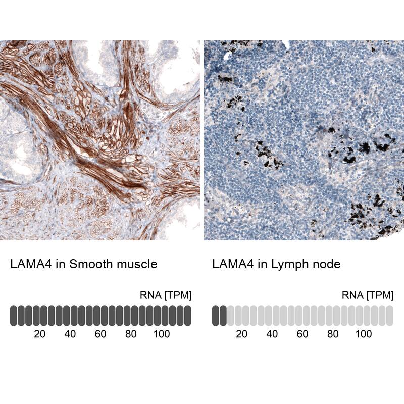 Laminin alpha 4 Antibody (CL3185) - Azide and BSA Free Immunohistochemistry-Paraffin: Laminin alpha 4 Antibody [NBP3-44409]