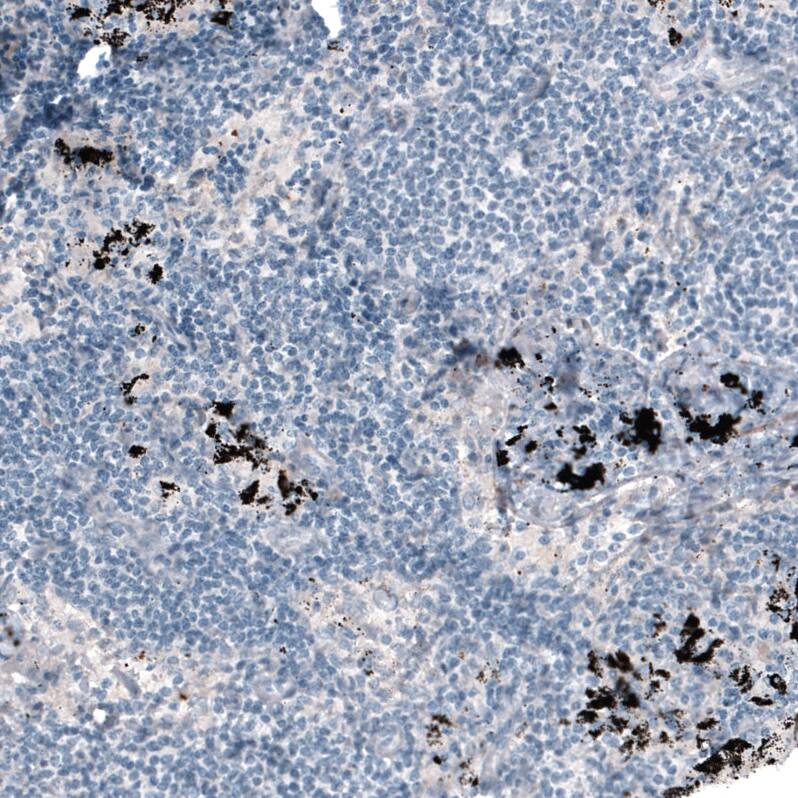 Laminin alpha 4 Antibody (CL3185) - Azide and BSA Free Immunohistochemistry-Paraffin: Laminin alpha 4 Antibody [NBP3-44409]