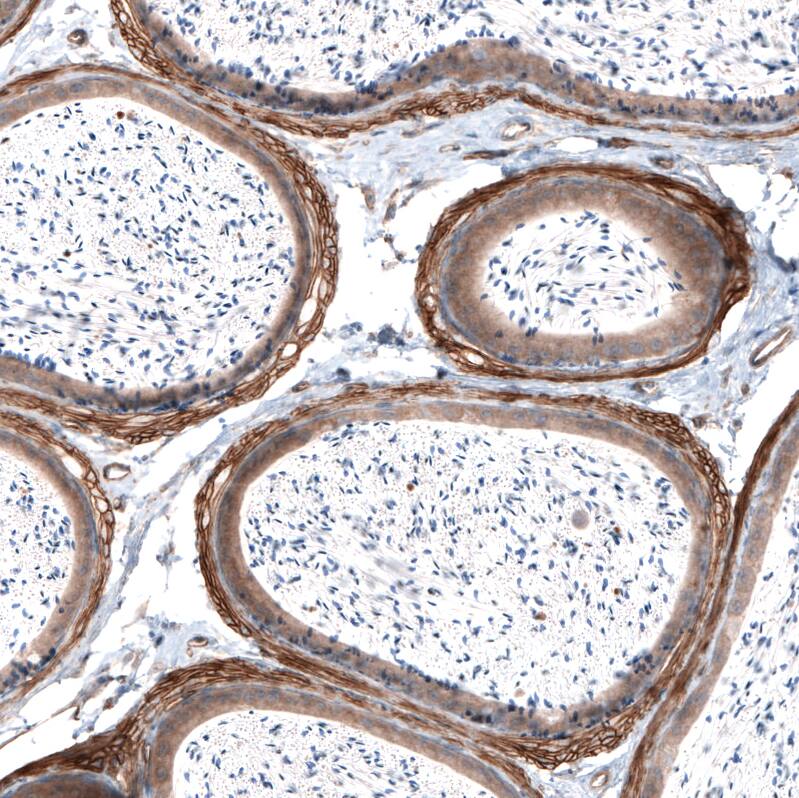 Laminin alpha 4 Antibody (CL3185) - Azide and BSA Free Immunohistochemistry-Paraffin: Laminin alpha 4 Antibody [NBP3-44409]