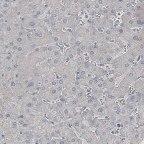 SSX2 Antibody (CL3202) - Azide and BSA Free Immunohistochemistry-Paraffin: SSX2 Antibody [NBP3-44410]