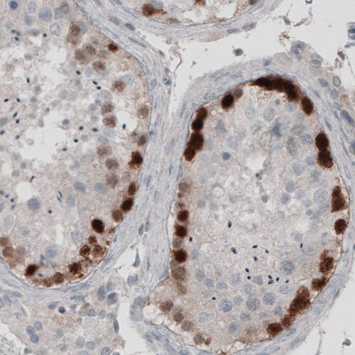 SSX2 Antibody (CL3202) - Azide and BSA Free Immunohistochemistry-Paraffin: SSX2 Antibody [NBP3-44410]