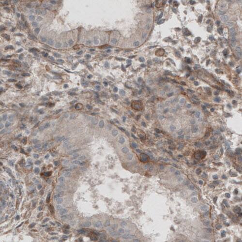 Laminin beta 1 Antibody (CL2970) - Azide and BSA Free Immunohistochemistry-Paraffin: Laminin beta 1 Antibody [NBP3-44411]