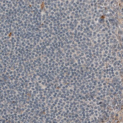 Laminin beta 1 Antibody (CL2970) - Azide and BSA Free Immunohistochemistry-Paraffin: Laminin beta 1 Antibody [NBP3-44411]
