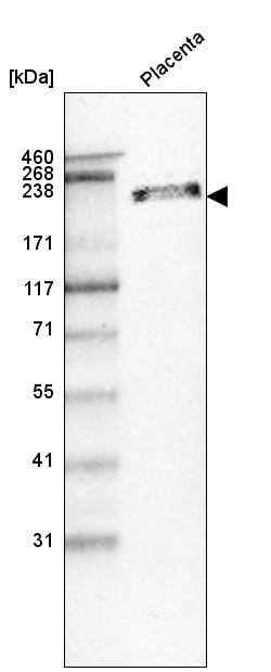 Laminin beta 1 Antibody (CL2970) - Azide and BSA Free Western Blot: Laminin beta 1 Antibody [NBP3-44411]