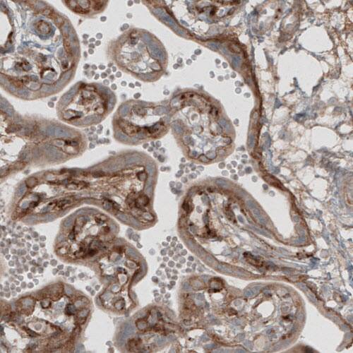 Laminin beta 1 Antibody (CL2970) - Azide and BSA Free Immunohistochemistry-Paraffin: Laminin beta 1 Antibody [NBP3-44411]