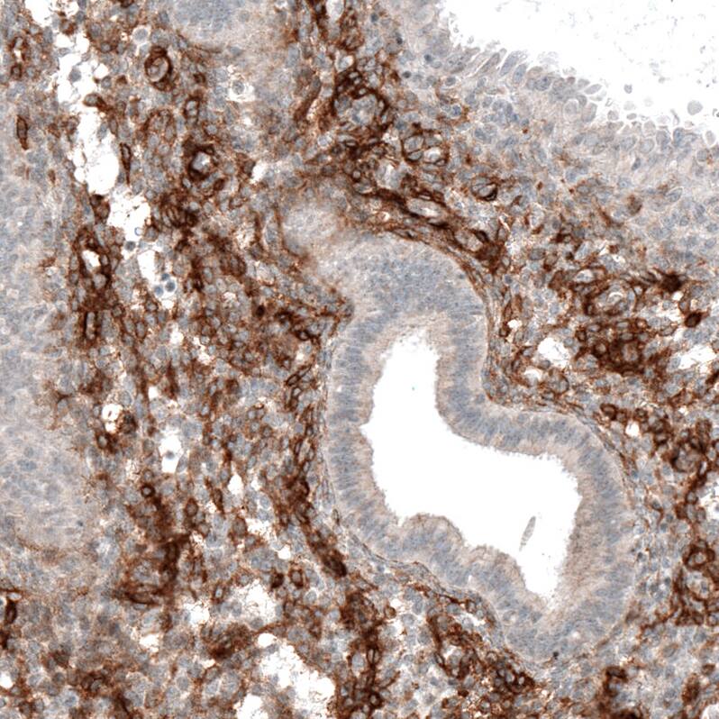 Integrin alpha 8 Antibody (CL7304) - Azide and BSA Free Immunohistochemistry-Paraffin: Integrin alpha 8 Antibody [NBP3-44412]
