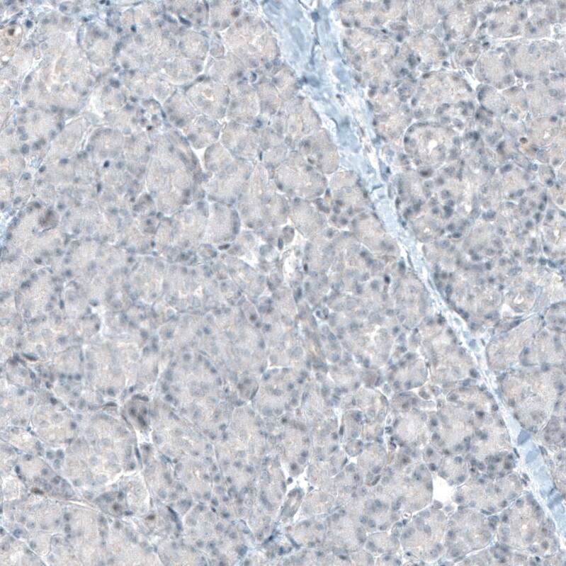 Integrin alpha 8 Antibody (CL7304) - Azide and BSA Free Immunohistochemistry-Paraffin: Integrin alpha 8 Antibody [NBP3-44412]