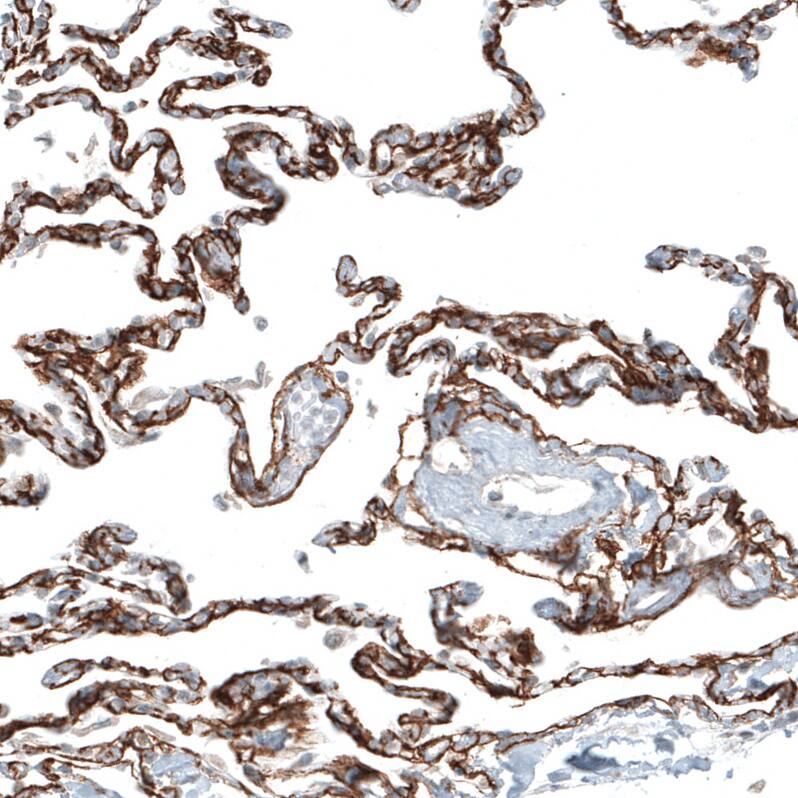 Integrin alpha 8 Antibody (CL7304) - Azide and BSA Free Immunohistochemistry-Paraffin: Integrin alpha 8 Antibody [NBP3-44412]