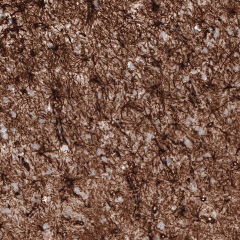 GFAP Antibody (CL2713) - Azide and BSA Free Immunohistochemistry-Paraffin: GFAP Antibody [NBP3-44413]