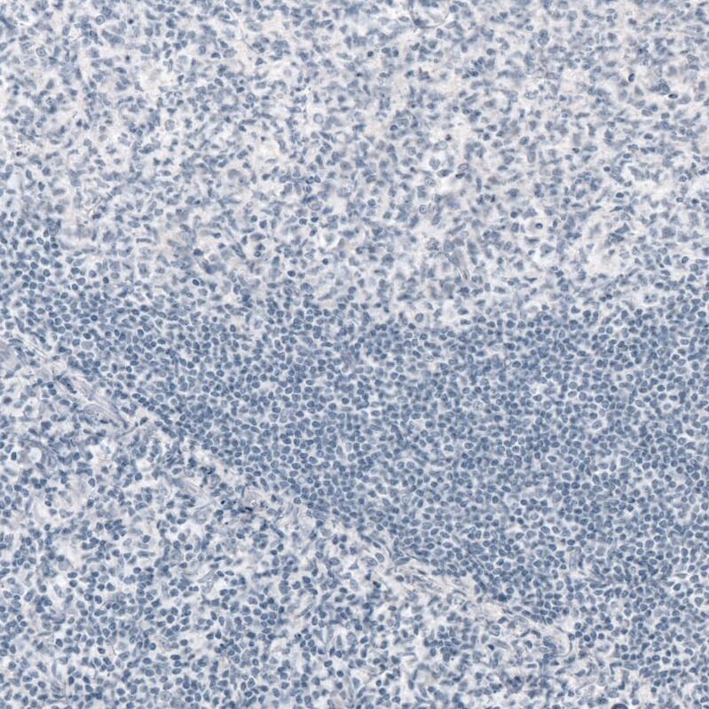 GFAP Antibody (CL2713) - Azide and BSA Free Immunohistochemistry-Paraffin: GFAP Antibody [NBP3-44413]