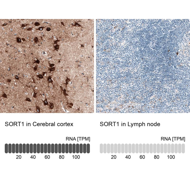 Sortilin Antibody (CL6526) - Azide and BSA Free Immunohistochemistry-Paraffin: Sortilin Antibody [NBP3-44414]