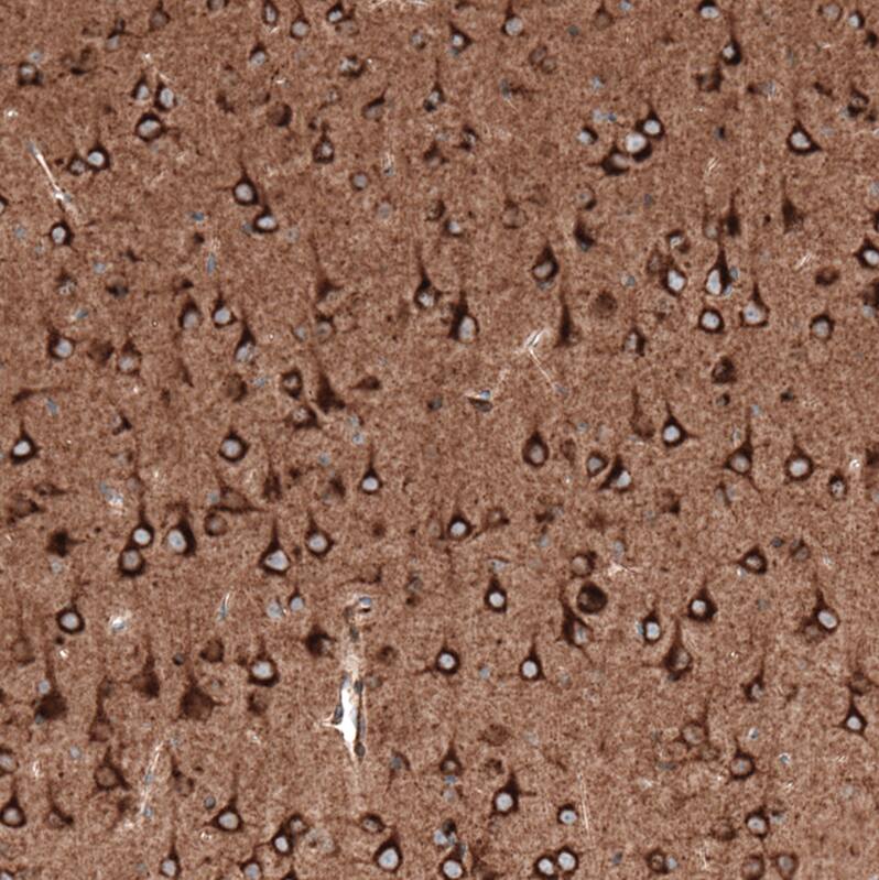 Sortilin Antibody (CL6526) - Azide and BSA Free Immunohistochemistry-Paraffin: Sortilin Antibody [NBP3-44414]