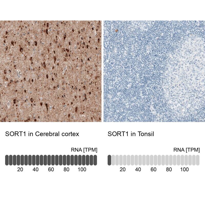 Sortilin Antibody (CL6528) - Azide and BSA Free Immunohistochemistry-Paraffin: Sortilin Antibody [NBP3-44415]