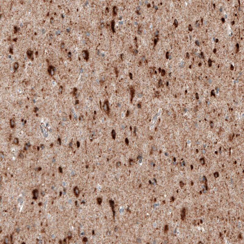 Sortilin Antibody (CL6528) - Azide and BSA Free Immunohistochemistry-Paraffin: Sortilin Antibody [NBP3-44415]